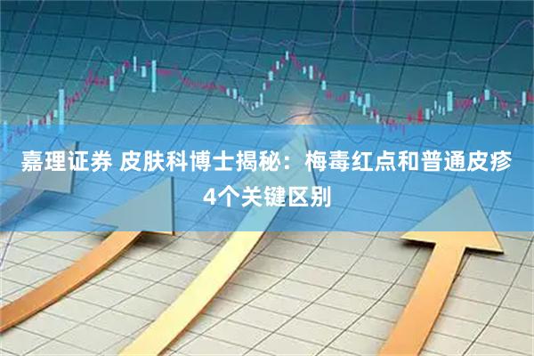 嘉理证券 皮肤科博士揭秘:梅毒红点和普通皮疹4个关键区别